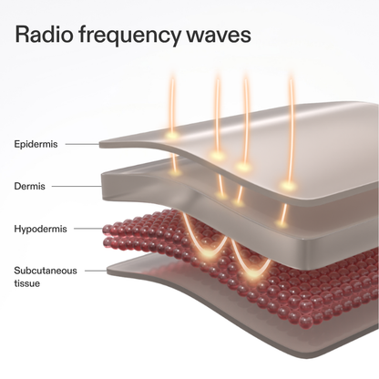 CurrentBody Skin RF Radio Frequency Skin Tightening Device – image 4